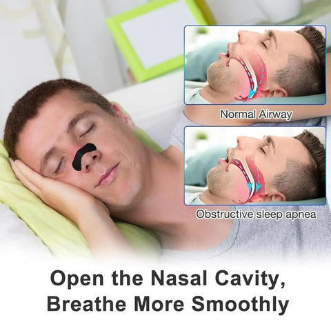 Nasal Breathing Strip 30pk